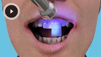 Emergency Dental Care