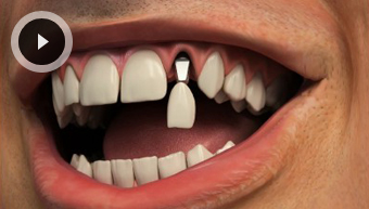 Emergency Dental Care